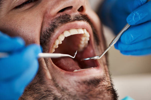 Best Same-Day Emergency Dental Services in East Mountain, TX