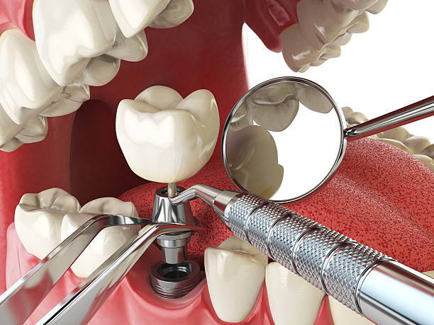 Best Cosmetic Emergency Dentistry in East Mountain, TX